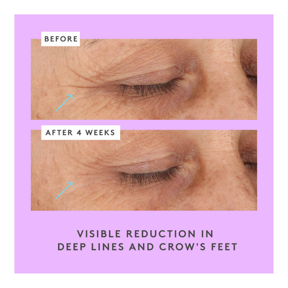 Ceramighty AF Eye Cream with Ceramides