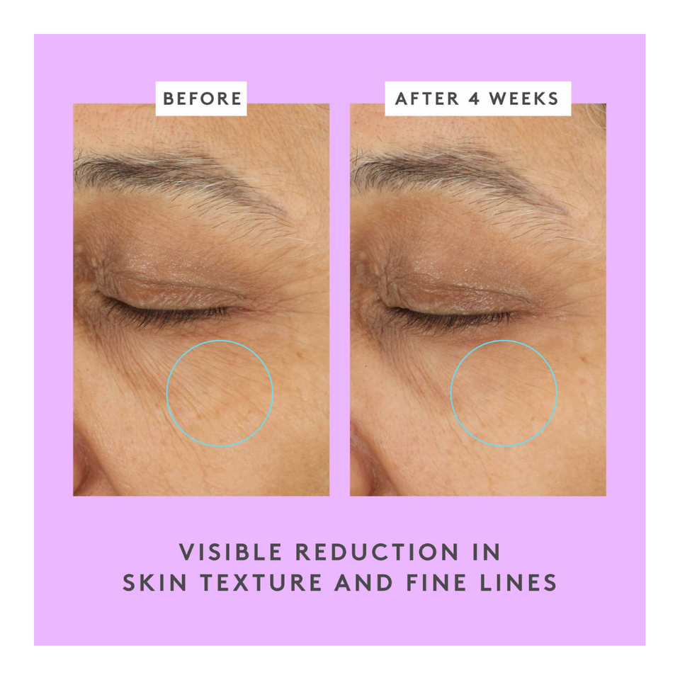 Ceramighty AF Eye Cream with Ceramides