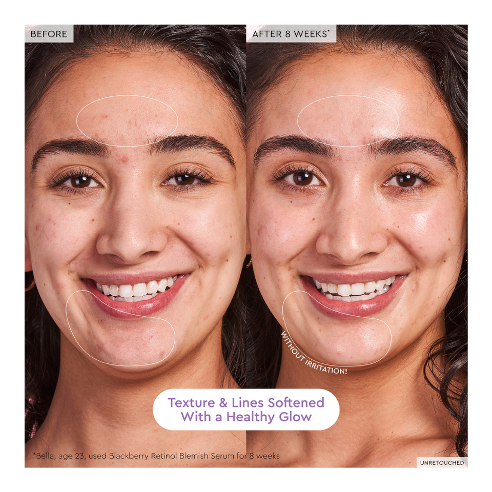 Blackberry Retinol Blemish Serum