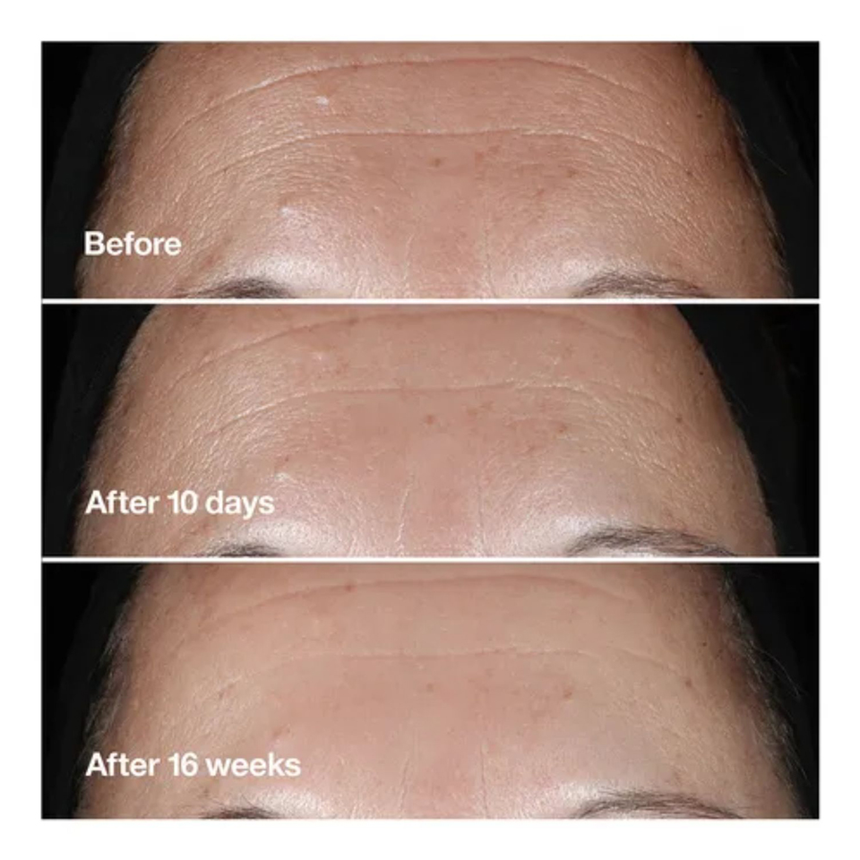 Smart Clinical Repair Wrinkle Correcting Serum