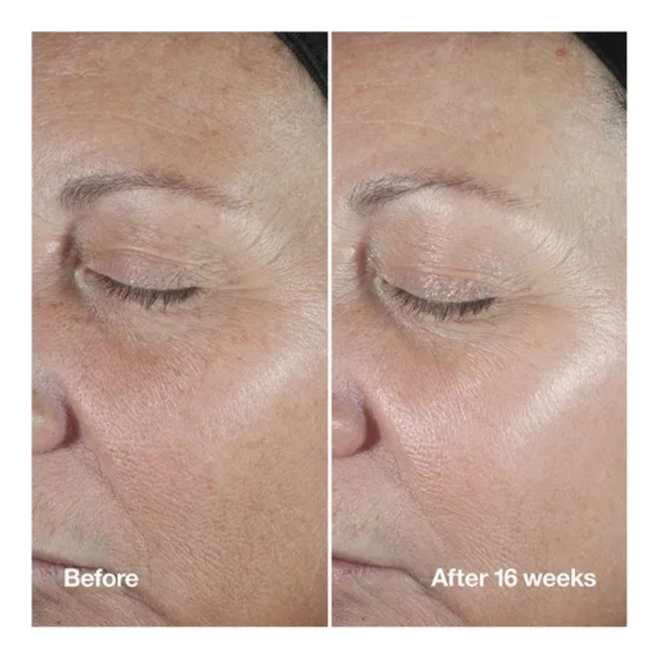 Smart Clinical Repair Wrinkle Correcting Serum