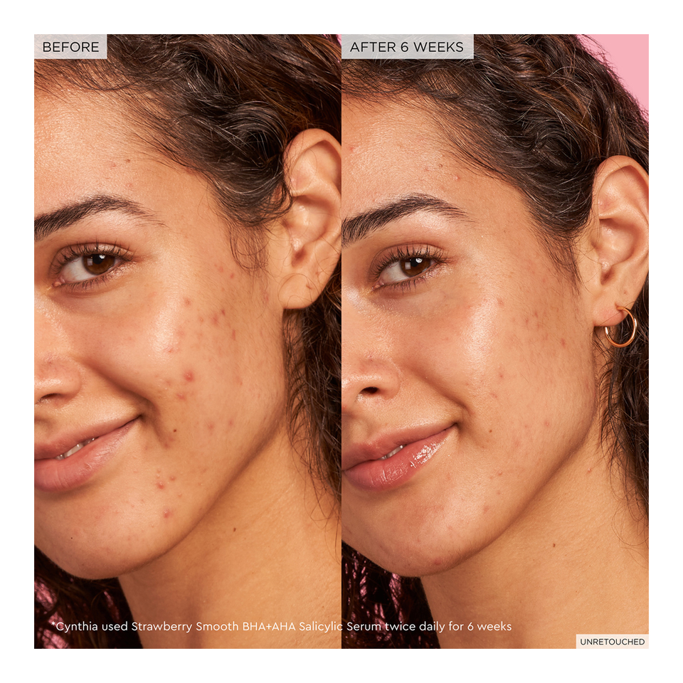 Strawberry Smooth BHA + AHA Salicylic Serum