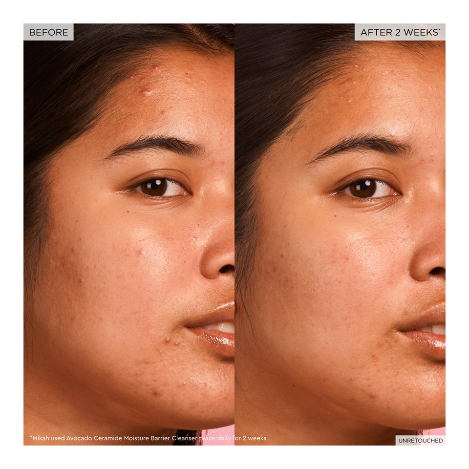 Avocado Ceramide Moisture Barrier Cleanser