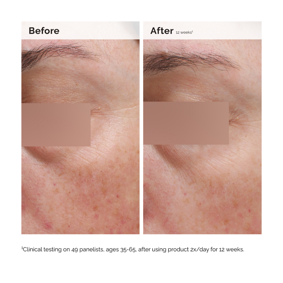 Niacinamide 5% Face and Body Emulsion