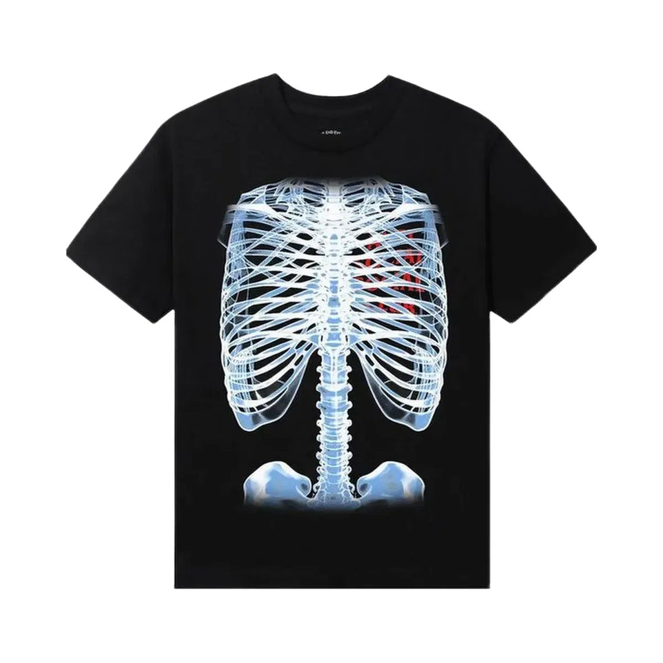Assc Anti Social Social Club Bones T-Shirt Black