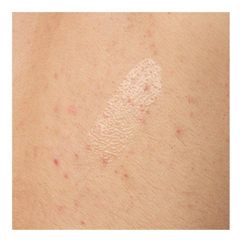 Salicylic Acid 0.5% Body Serum