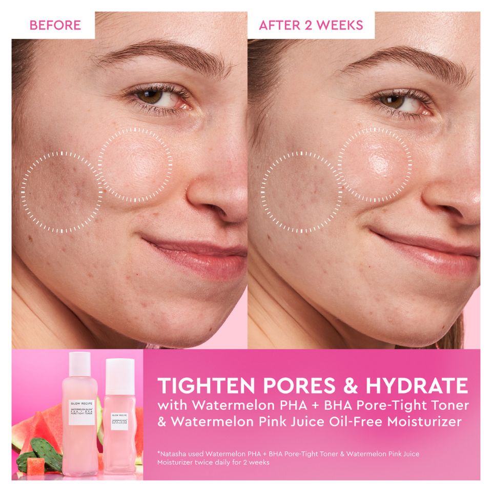Watermelon Glow Dewy Skin Routine Gift Set (Holiday Limited Edition)