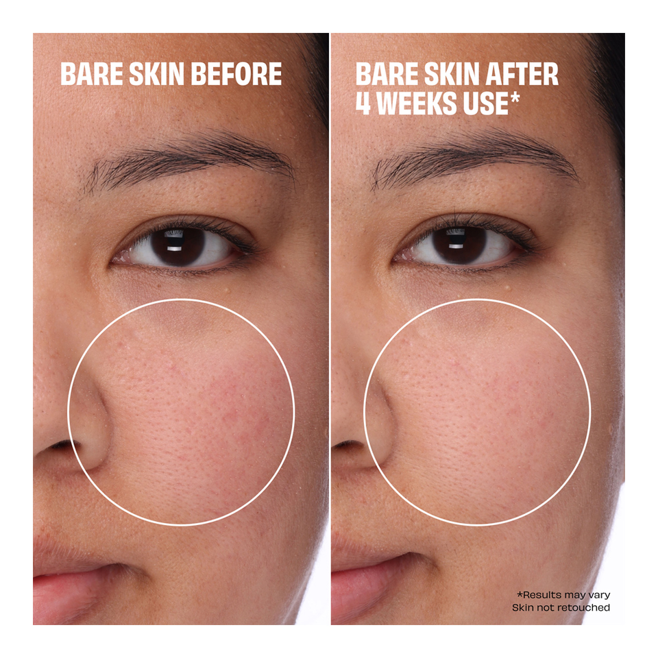 The Porefessional Foundation