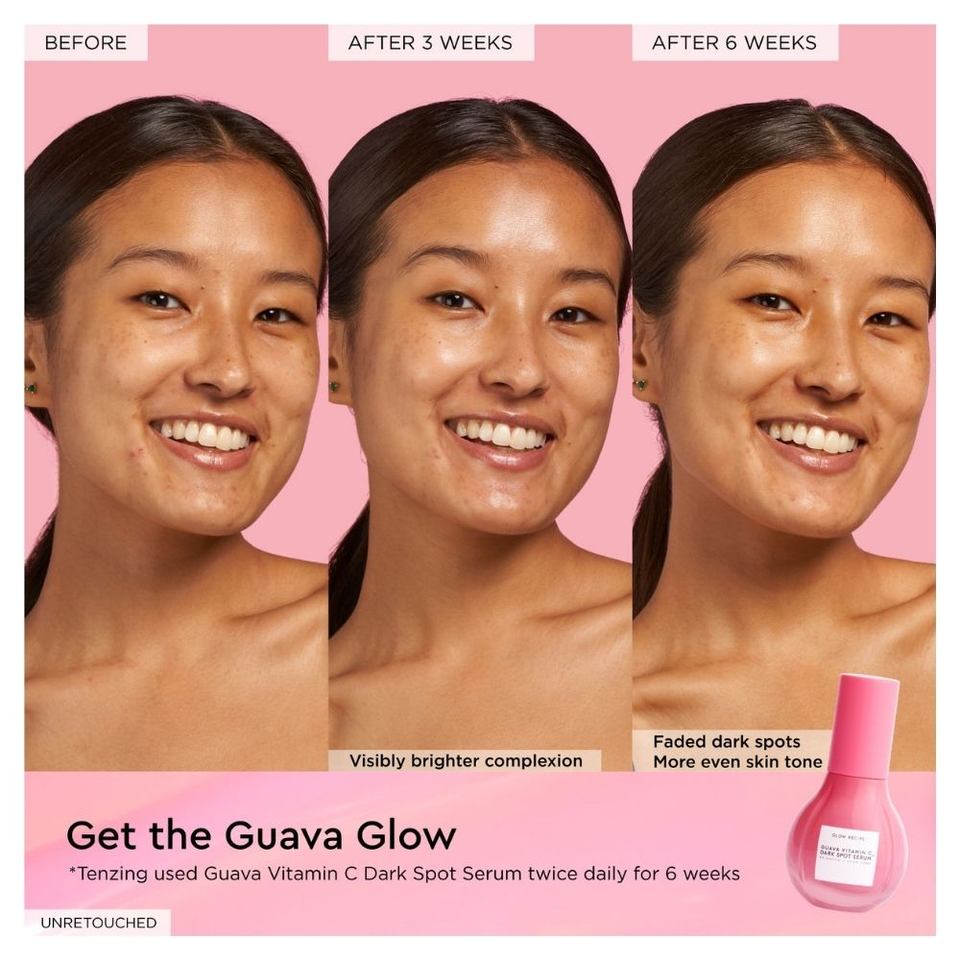 Guava Vitamin C Dark Spot Serum