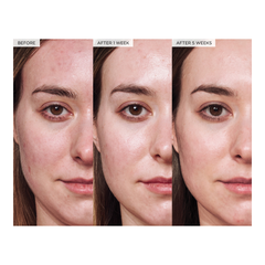 Avocado Ceramide Recovery Serum