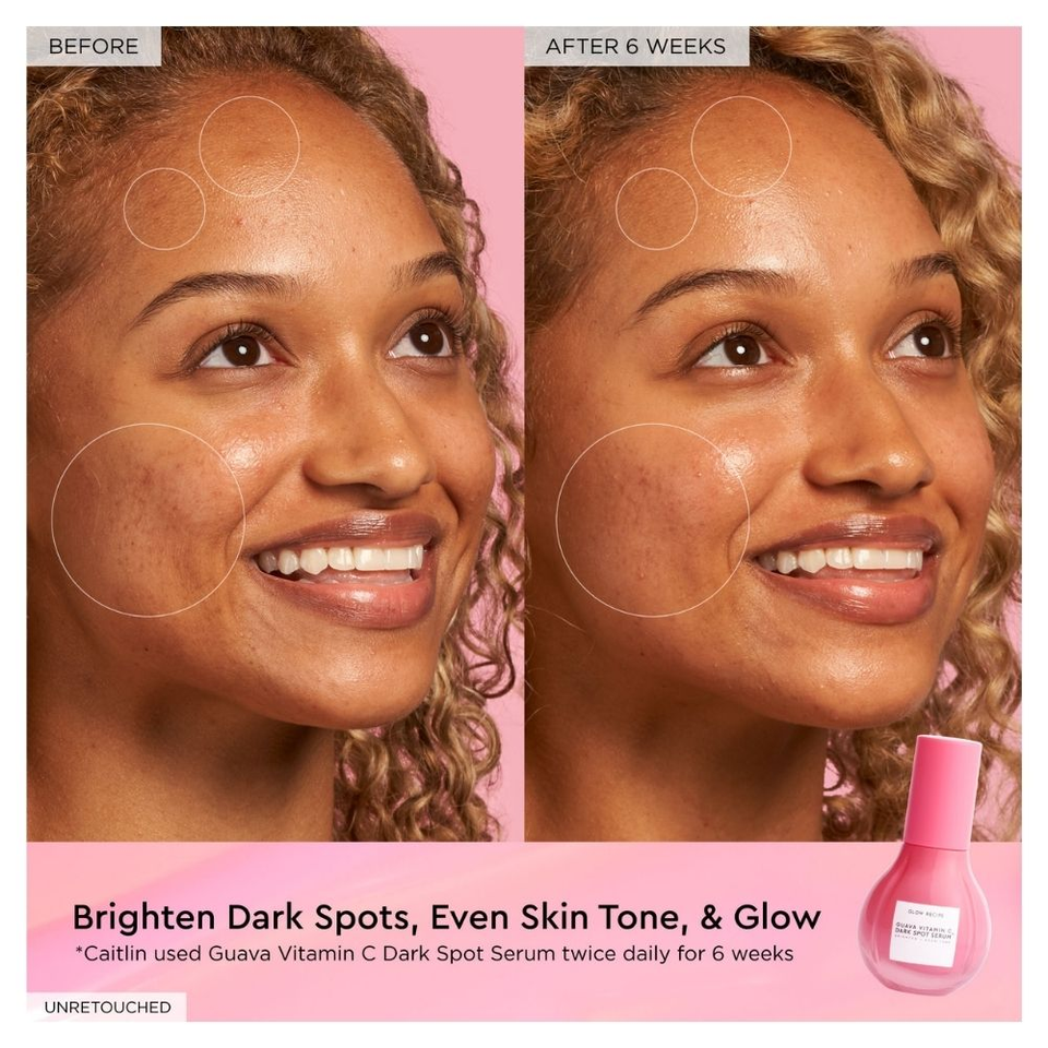 Guava Vitamin C Dark Spot Serum