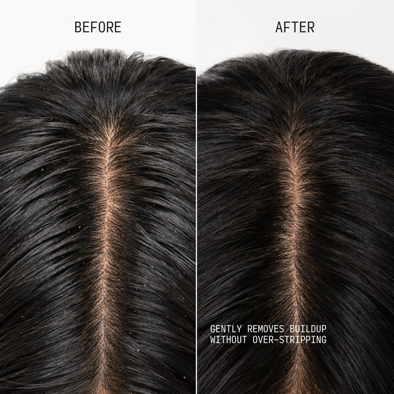 Clarifying Shampoo & Scalp Scrub