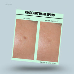 Peace Out Dark Spots